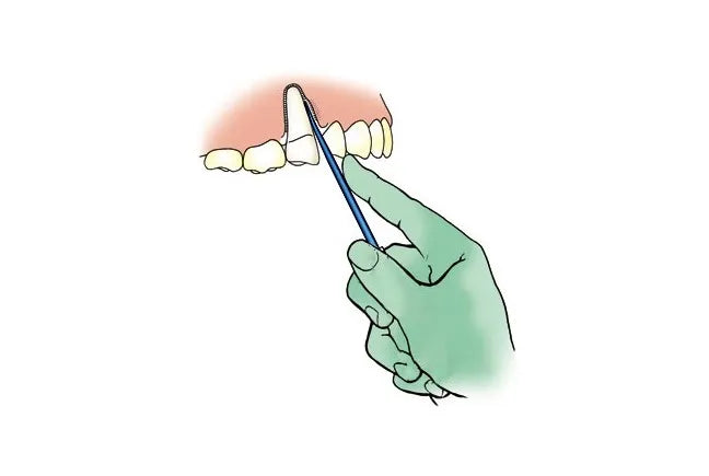 Midelux & Medimpla Rapid Loosening Tooth System